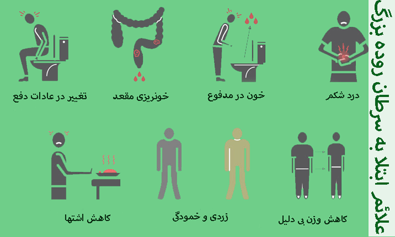 نشانه های ابتلا به سرطان روده بزرگ